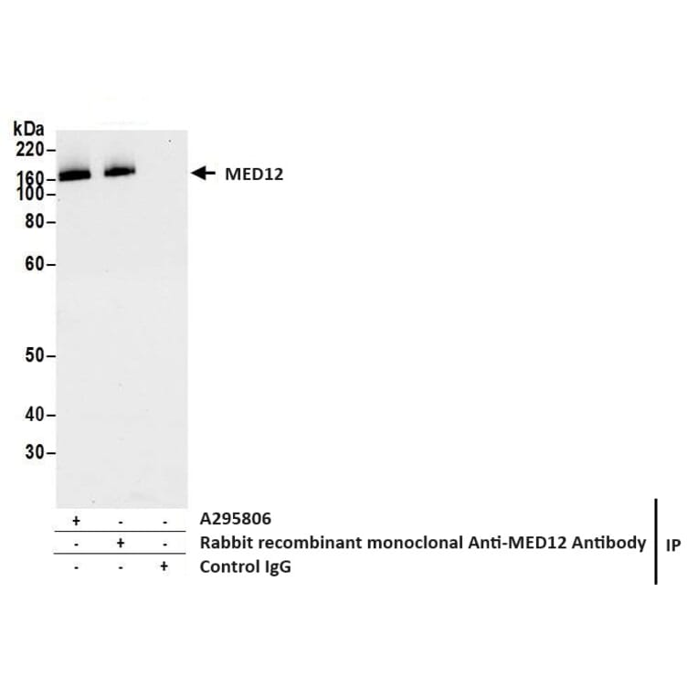 Immunoprecipitation - Anti-MED12 Antibody (A295806) - Antibodies.com
