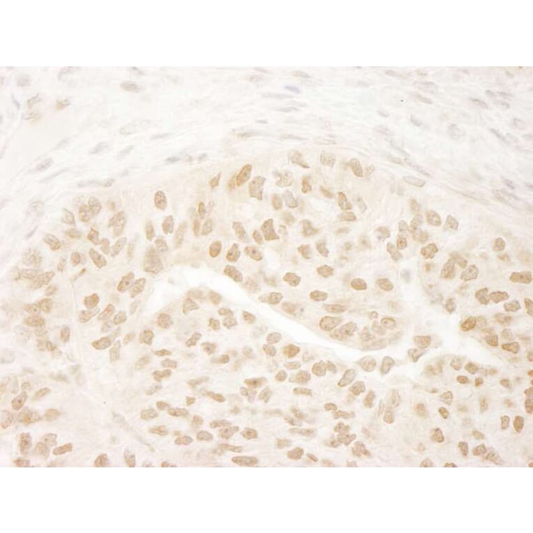 Immunohistochemistry - Anti-KMT4 / Dot1L Antibody (A295971) - Antibodies.com