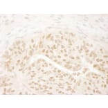 Immunohistochemistry - Anti-KMT4 / Dot1L Antibody (A295971) - Antibodies.com