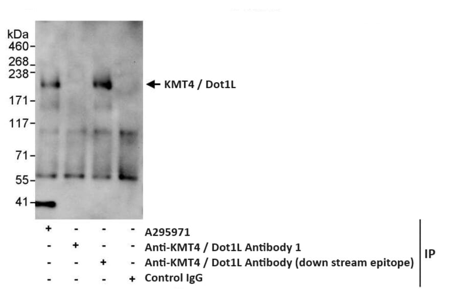 Immunoprecipitation - Anti-KMT4 / Dot1L Antibody (A295971) - Antibodies.com