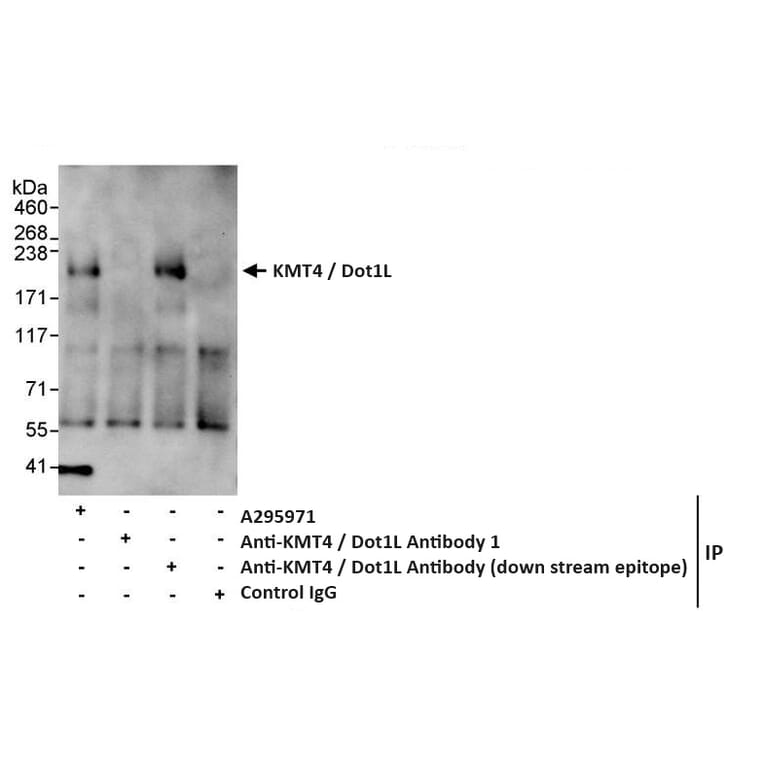 Immunoprecipitation - Anti-KMT4 / Dot1L Antibody (A295971) - Antibodies.com