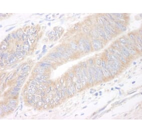 Immunohistochemistry - Anti-CIP2A Antibody (A296475) - Antibodies.com