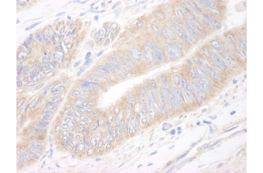 Immunohistochemistry - Anti-CIP2A Antibody (A296475) - Antibodies.com