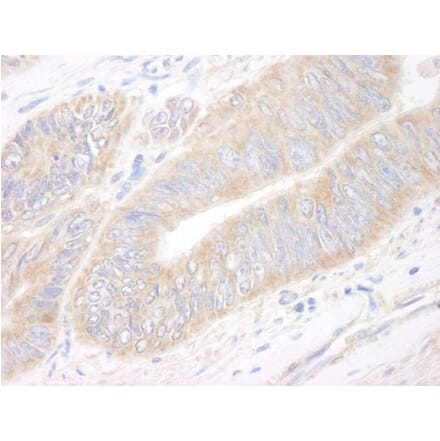 Immunohistochemistry - Anti-CIP2A Antibody (A296475) - Antibodies.com