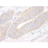 Immunohistochemistry - Anti-CIP2A Antibody (A296475) - Antibodies.com