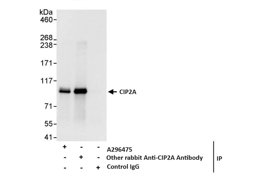 Immunoprecipitation - Anti-CIP2A Antibody (A296475) - Antibodies.com
