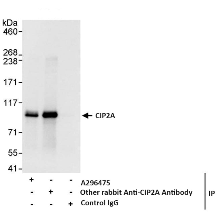 Immunoprecipitation - Anti-CIP2A Antibody (A296475) - Antibodies.com