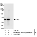 Immunoprecipitation - Anti-CIP2A Antibody (A296475) - Antibodies.com