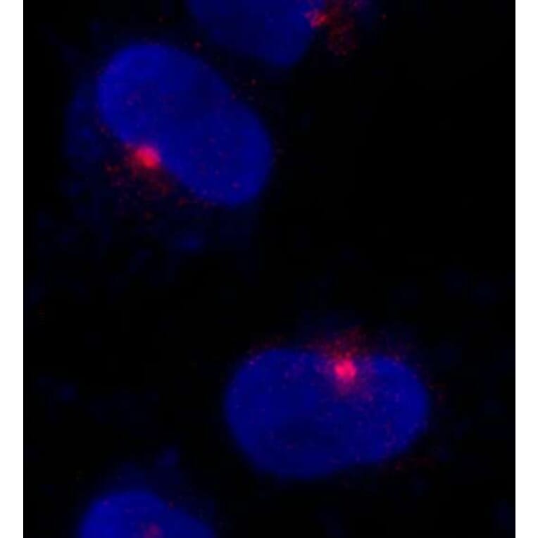 Immunocytochemistry - Anti-CEP290 Antibody (A296657) - Antibodies.com