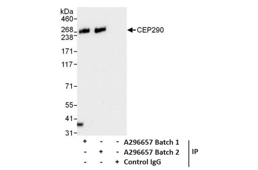 Immunoprecipitation - Anti-CEP290 Antibody (A296657) - Antibodies.com