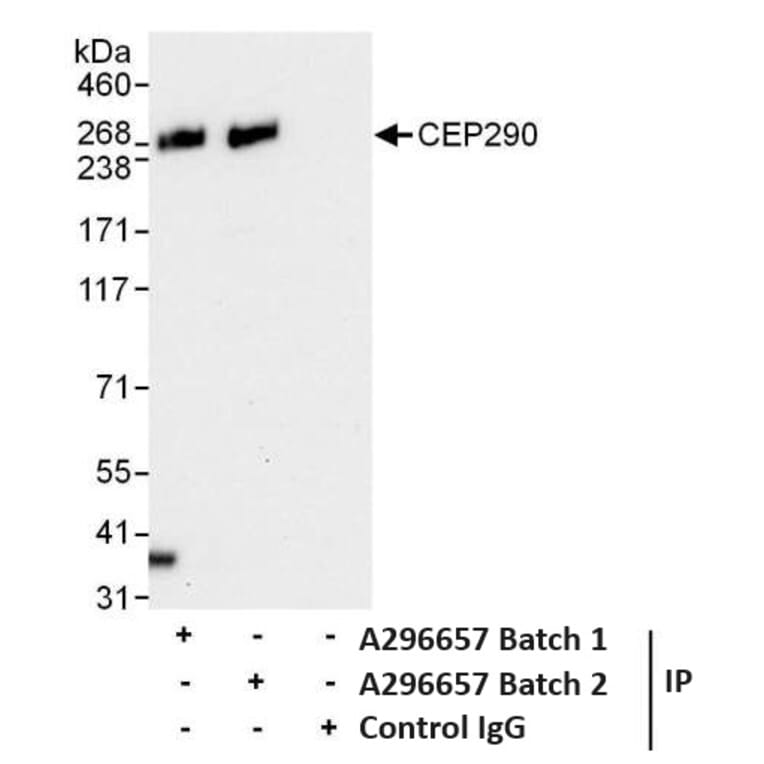 Immunoprecipitation - Anti-CEP290 Antibody (A296657) - Antibodies.com