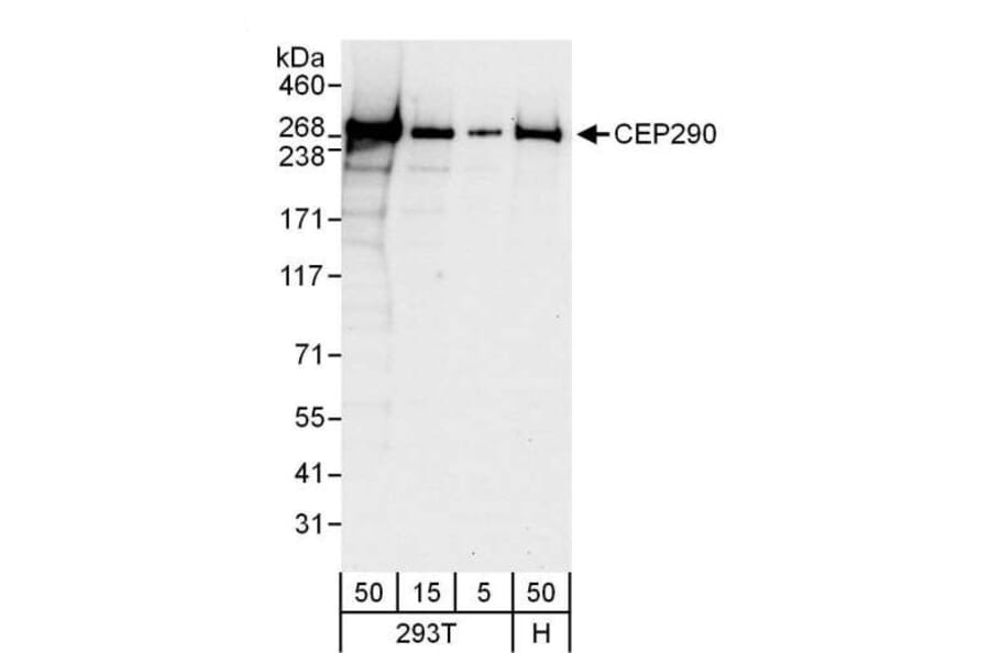 Western Blot - Anti-CEP290 Antibody (A296657) - Antibodies.com