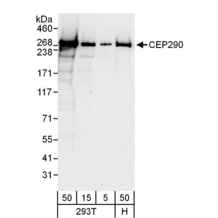 Western Blot - Anti-CEP290 Antibody (A296657) - Antibodies.com