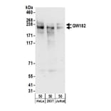 Western Blot - Anti-GW182 Antibody (A297273) - Antibodies.com