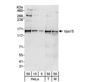 Western Blot - Anti-VPS15 Antibody (A297489) - Antibodies.com