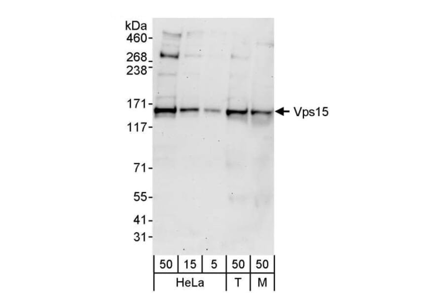 Western Blot - Anti-VPS15 Antibody (A297489) - Antibodies.com