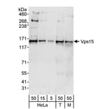 Western Blot - Anti-VPS15 Antibody (A297489) - Antibodies.com
