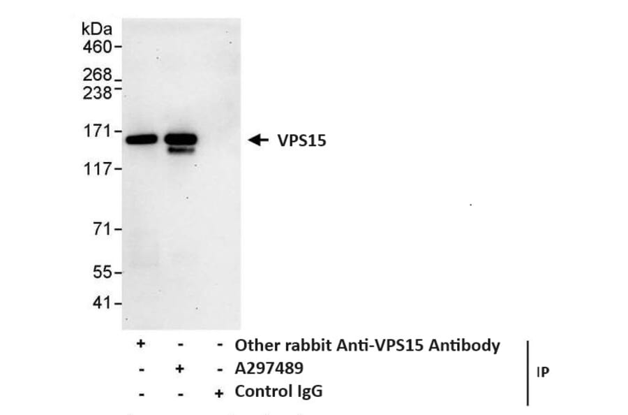 Immunoprecipitation - Anti-VPS15 Antibody (A297489) - Antibodies.com