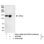 Immunoprecipitation - Anti-VPS15 Antibody (A297489) - Antibodies.com