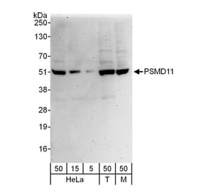 Western Blot - Anti-PSMD11 Antibody (A297656) - Antibodies.com