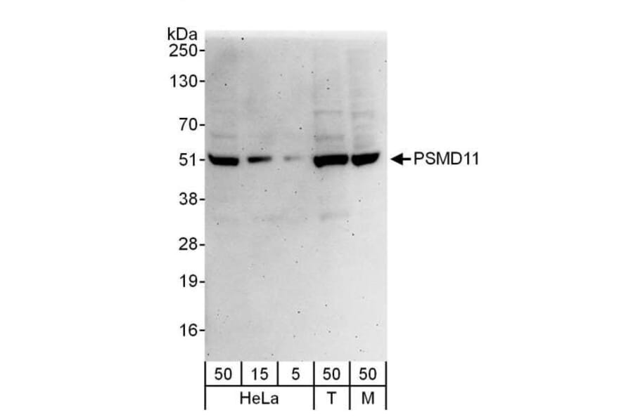 Western Blot - Anti-PSMD11 Antibody (A297656) - Antibodies.com