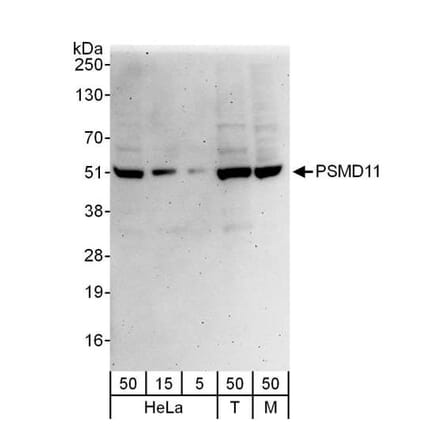 Western Blot - Anti-PSMD11 Antibody (A297656) - Antibodies.com
