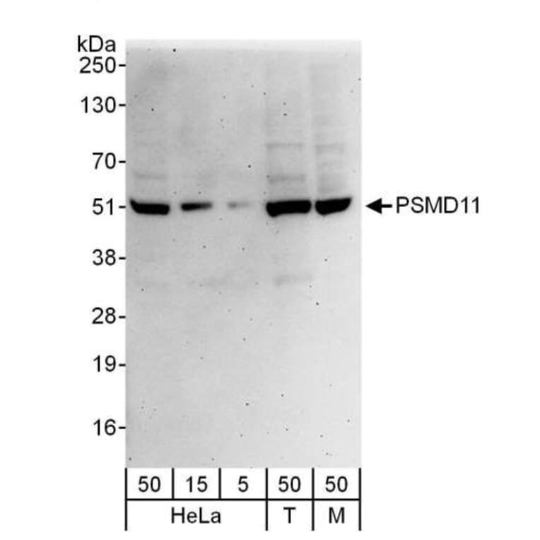 Western Blot - Anti-PSMD11 Antibody (A297656) - Antibodies.com
