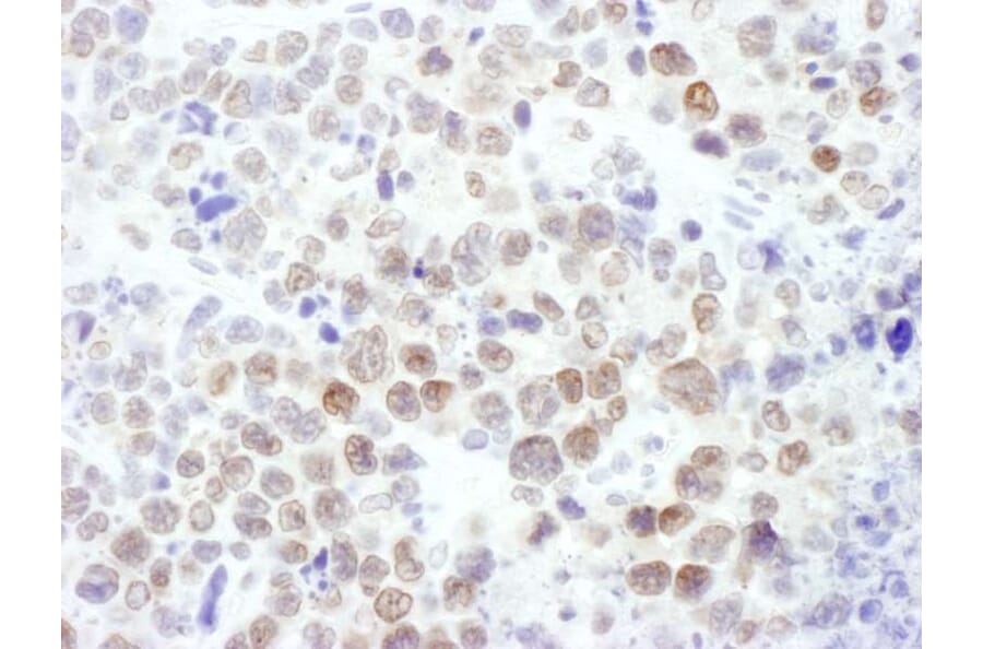 Immunohistochemistry - Anti-EZH2 Antibody (A298974) - Antibodies.com