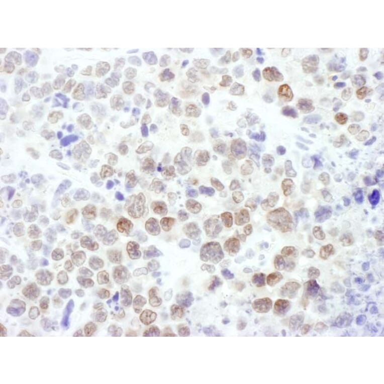 Immunohistochemistry - Anti-EZH2 Antibody (A298974) - Antibodies.com