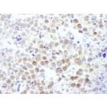 Immunohistochemistry - Anti-EZH2 Antibody (A298974) - Antibodies.com