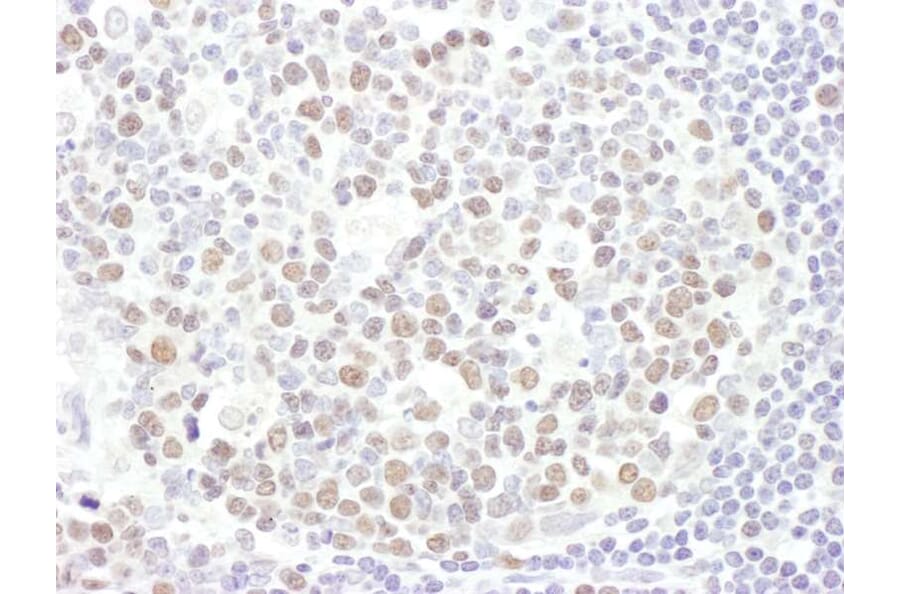 Immunohistochemistry - Anti-EZH2 Antibody (A298974) - Antibodies.com