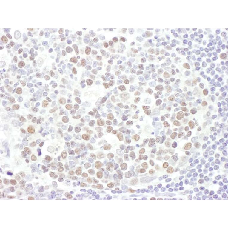 Immunohistochemistry - Anti-EZH2 Antibody (A298974) - Antibodies.com