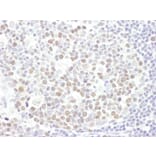 Immunohistochemistry - Anti-EZH2 Antibody (A298974) - Antibodies.com