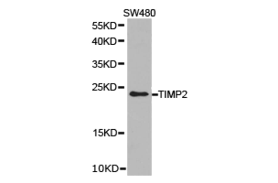 Anti-TIMP2 Antibody from Bioworld Technology (BS6747) - Antibodies.com
