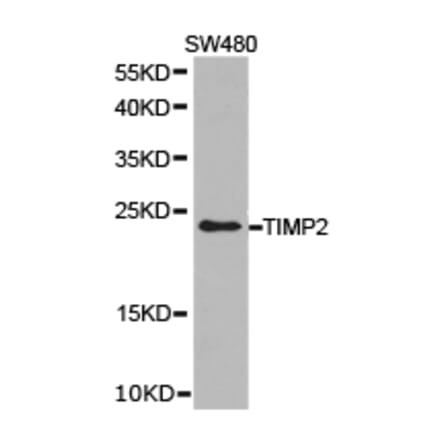 Anti-TIMP2 Antibody from Bioworld Technology (BS6747) - Antibodies.com