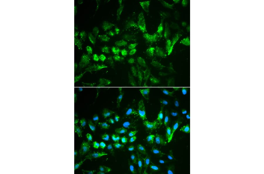Anti-TIMP2 Antibody from Bioworld Technology (BS6747) - Antibodies.com