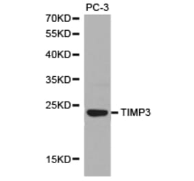 Anti-TIMP3 Antibody from Bioworld Technology (BS6748) - Antibodies.com