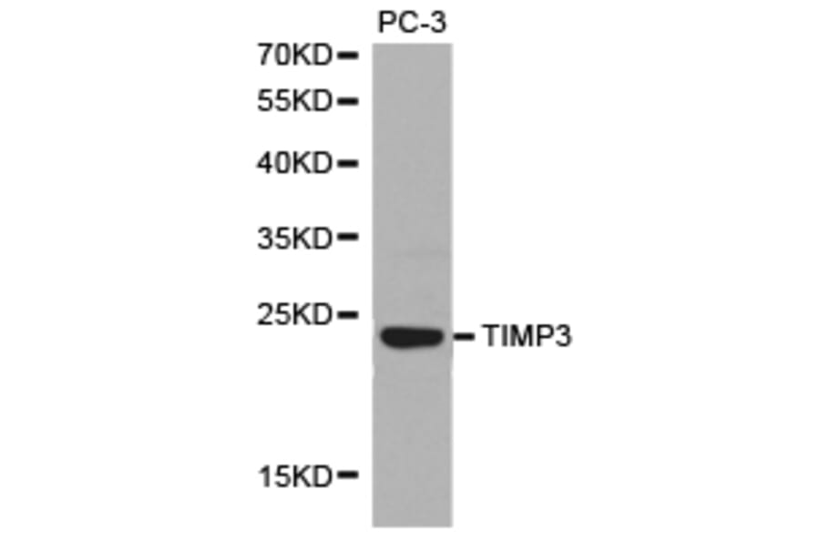 Anti-TIMP3 Antibody from Bioworld Technology (BS6748) - Antibodies.com