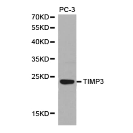 Anti-TIMP3 Antibody from Bioworld Technology (BS6748) - Antibodies.com