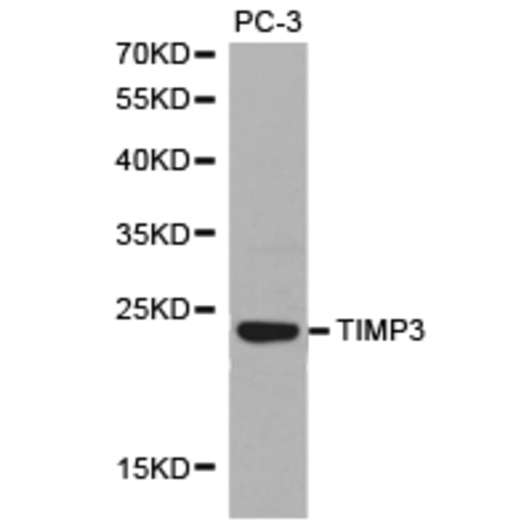 Anti-TIMP3 Antibody from Bioworld Technology (BS6748) - Antibodies.com