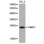 Anti-TIMP3 Antibody from Bioworld Technology (BS6748) - Antibodies.com