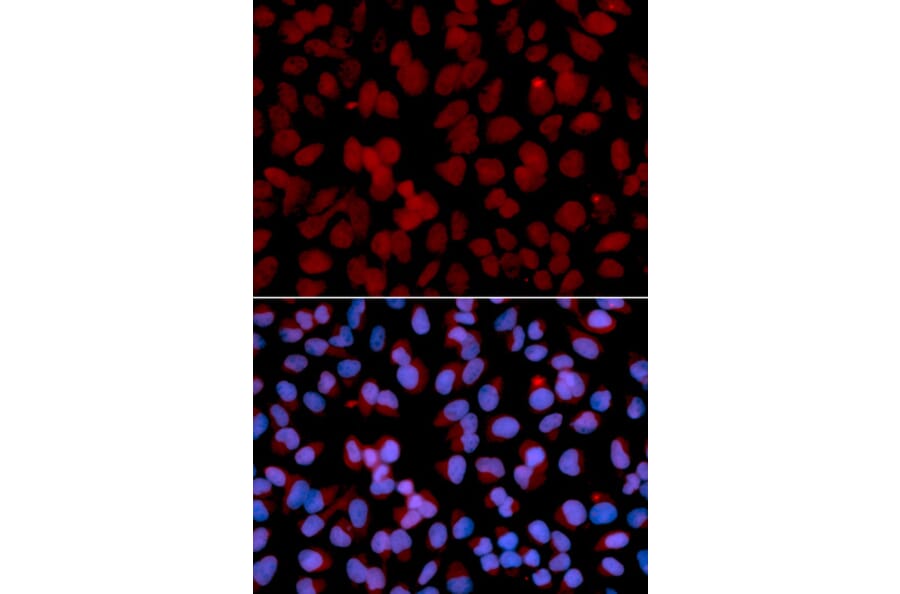 Anti-TNFAIP3 Antibody from Bioworld Technology (BS6751) - Antibodies.com
