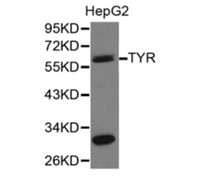 Anti-TYR Antibody from Bioworld Technology (BS6754) - Antibodies.com