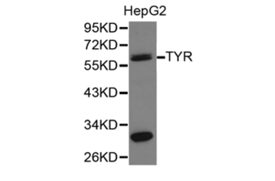 Anti-TYR Antibody from Bioworld Technology (BS6754) - Antibodies.com