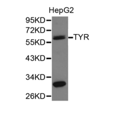 Anti-TYR Antibody from Bioworld Technology (BS6754) - Antibodies.com