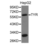 Anti-TYR Antibody from Bioworld Technology (BS6754) - Antibodies.com