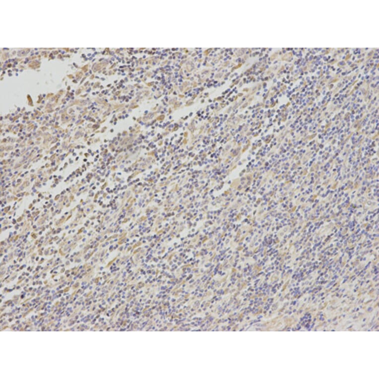 Anti-TYR Antibody from Bioworld Technology (BS6754) - Antibodies.com