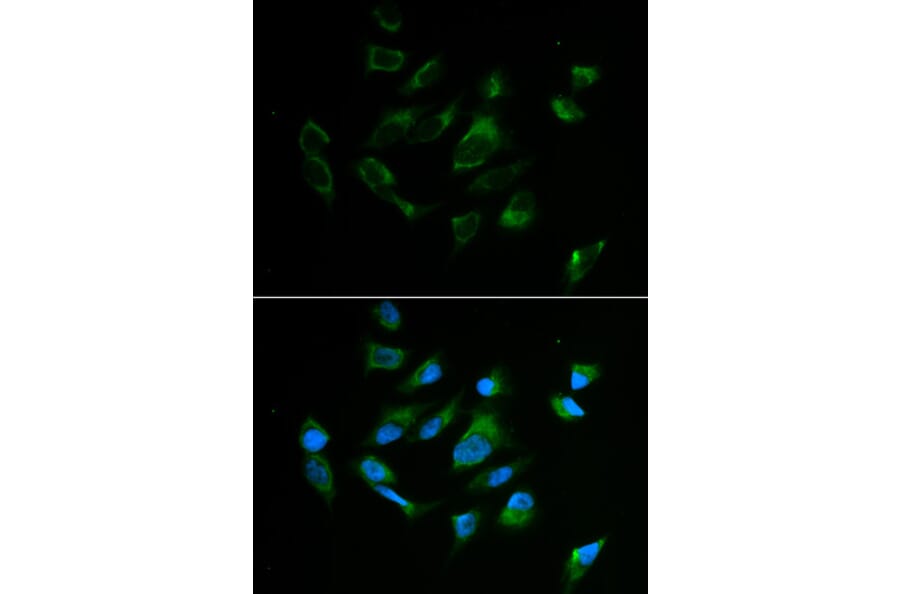 Anti-TYR Antibody from Bioworld Technology (BS6754) - Antibodies.com
