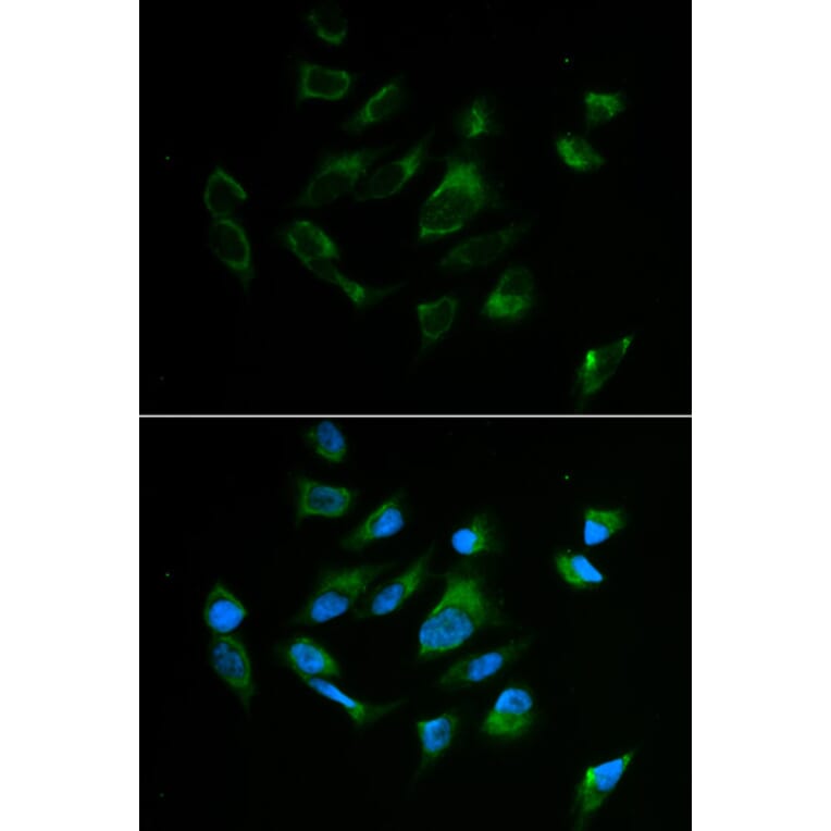 Anti-TYR Antibody from Bioworld Technology (BS6754) - Antibodies.com