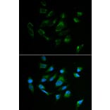 Anti-TYR Antibody from Bioworld Technology (BS6754) - Antibodies.com